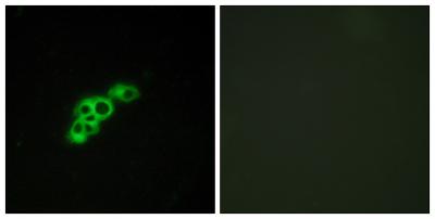 FSHR Polyclonal Antibody