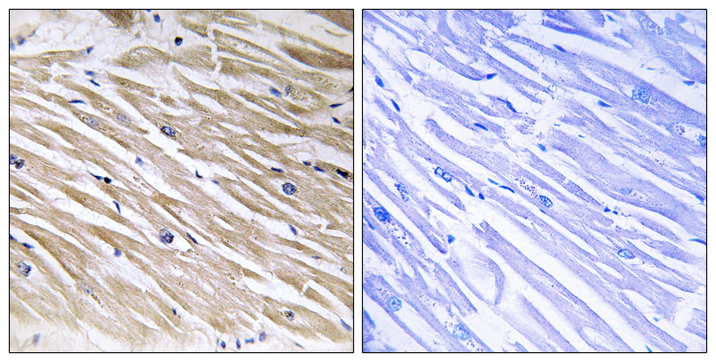 PEA-15 Polyclonal Antibody