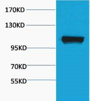 PEPC Polyclonal Antibody