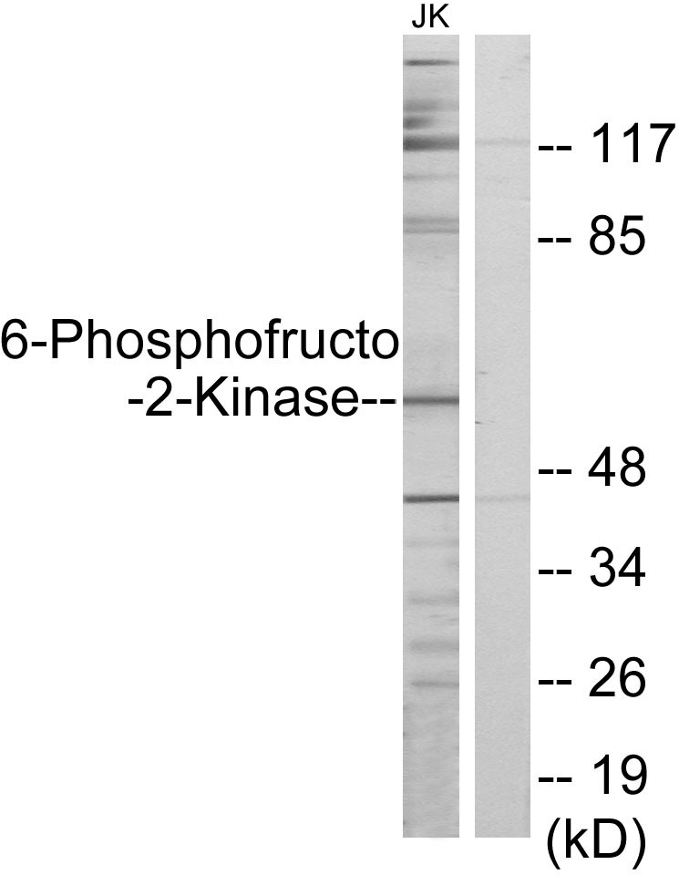 PFK-2 car Polyclonal Antibody