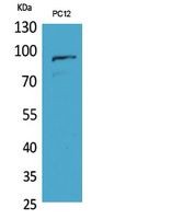 PCAF Polyclonal Antibody