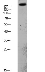 PDGFR-α Polyclonal Antibody