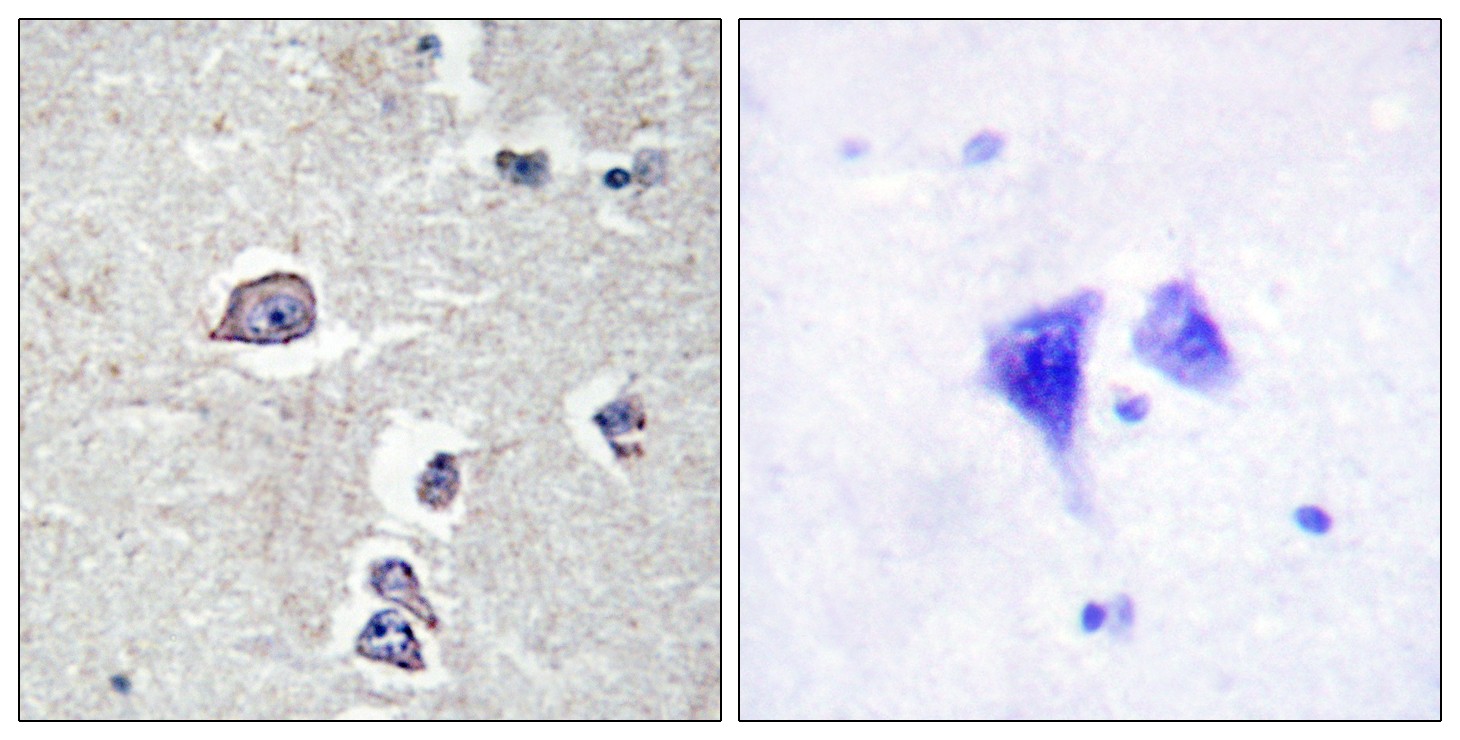 PDGFR-α Polyclonal Antibody