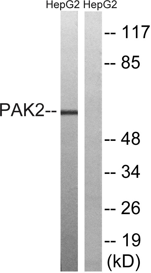 PAKγ Polyclonal Antibody