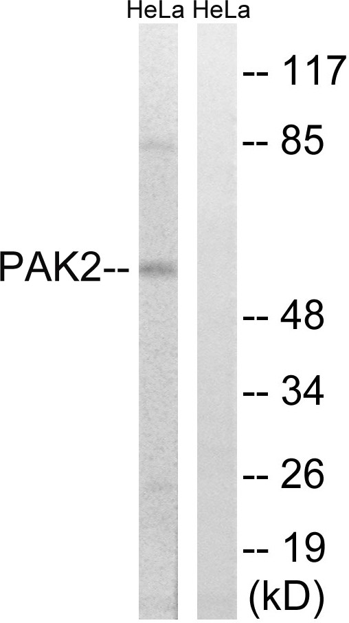 PAKγ Polyclonal Antibody