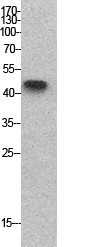 p53 Polyclonal Antibody