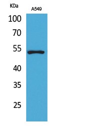 p53 Polyclonal Antibody