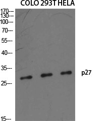 p27 Polyclonal Antibody