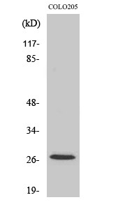 p27 Polyclonal Antibody