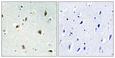 p27 Polyclonal Antibody