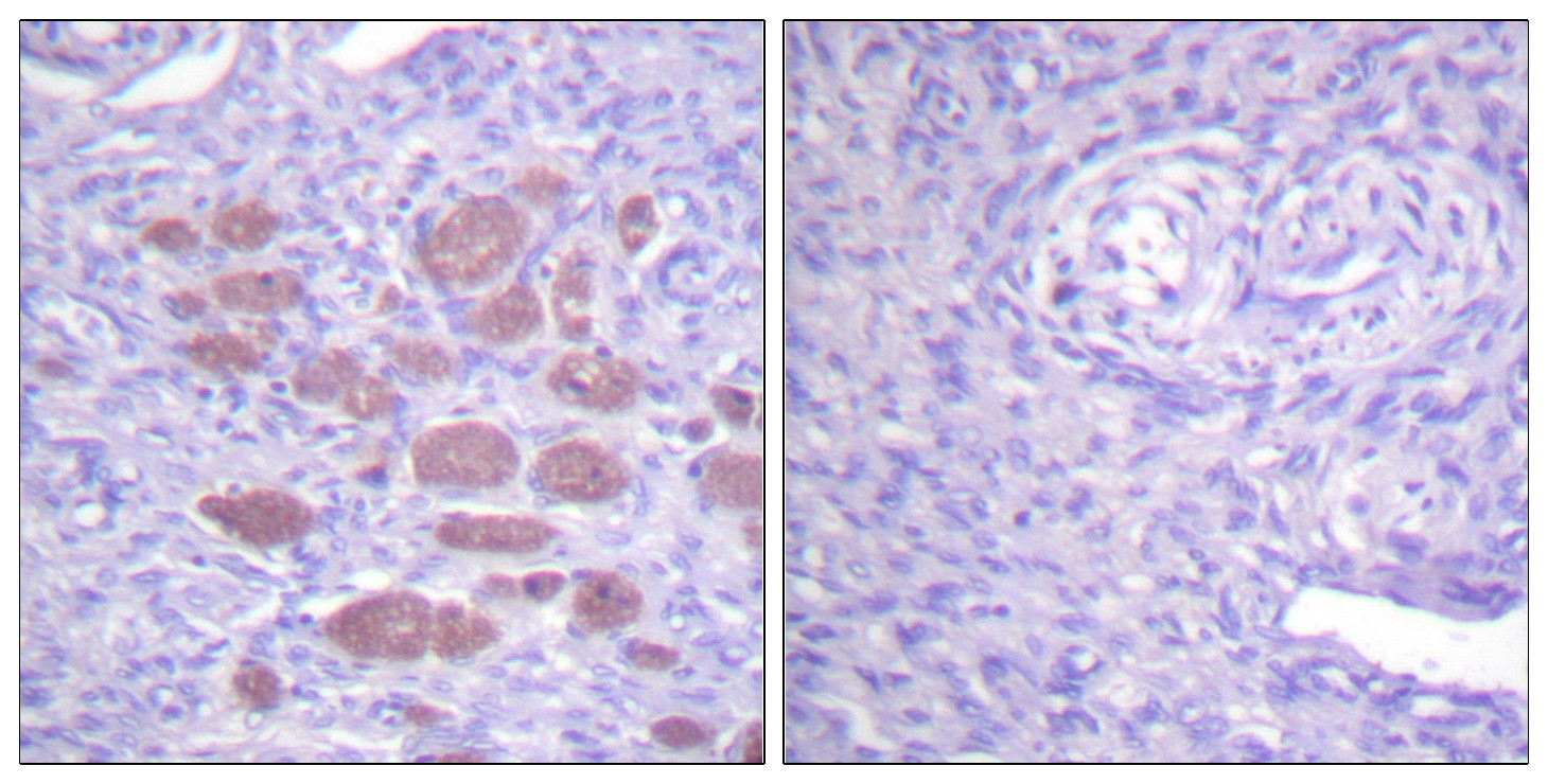 p40-phox Polyclonal Antibody