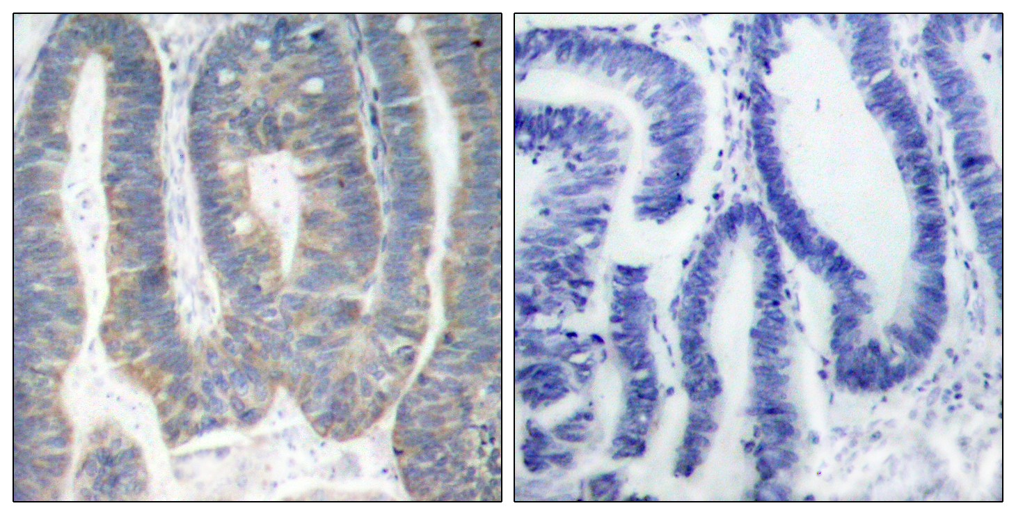 PKR Polyclonal Antibody