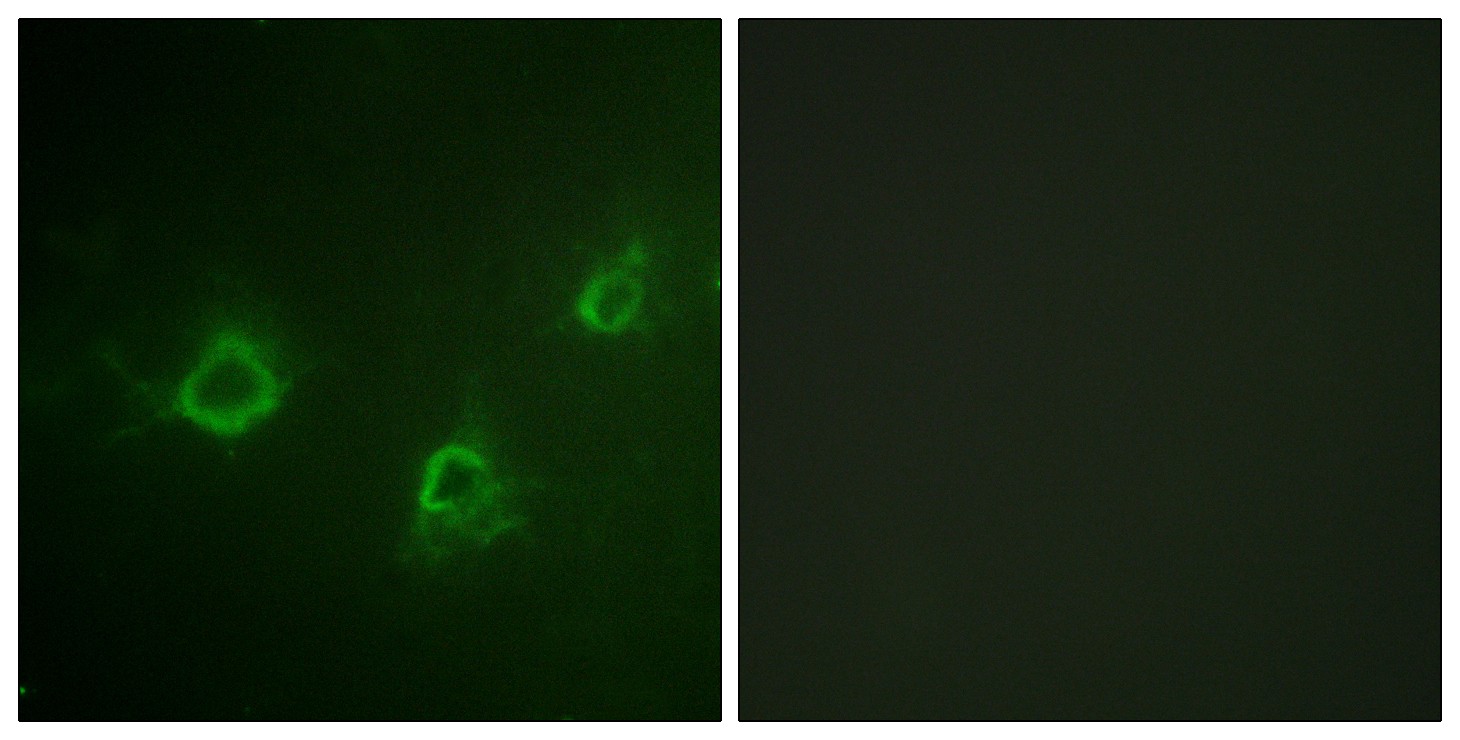 PLC γ1 Polyclonal Antibody