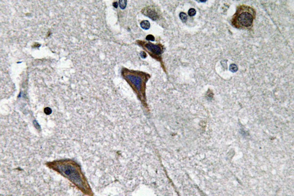 Ob-R Polyclonal Antibody