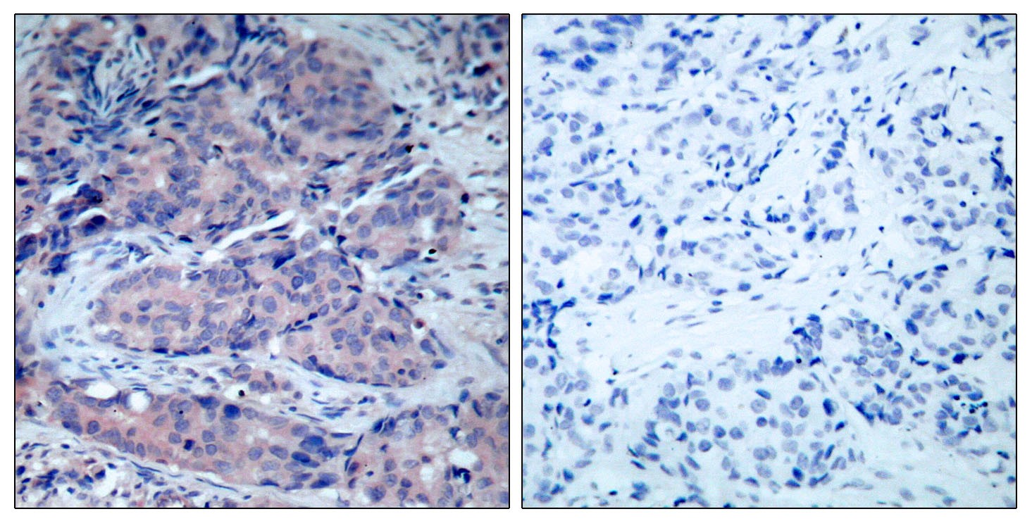 MEK-4 Polyclonal Antibody