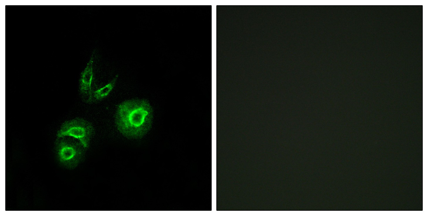 Met Polyclonal Antibody