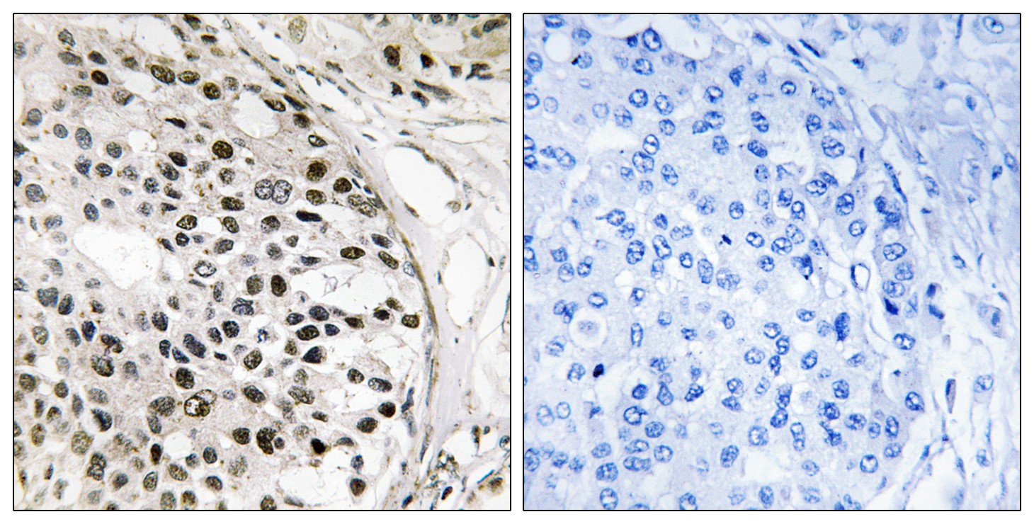 Mnk1 Polyclonal Antibody