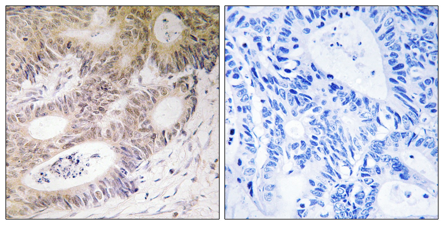 MSK1 Polyclonal Antibody