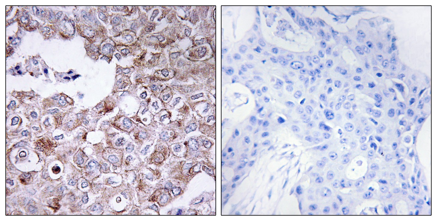 Mucin 1 Polyclonal Antibody