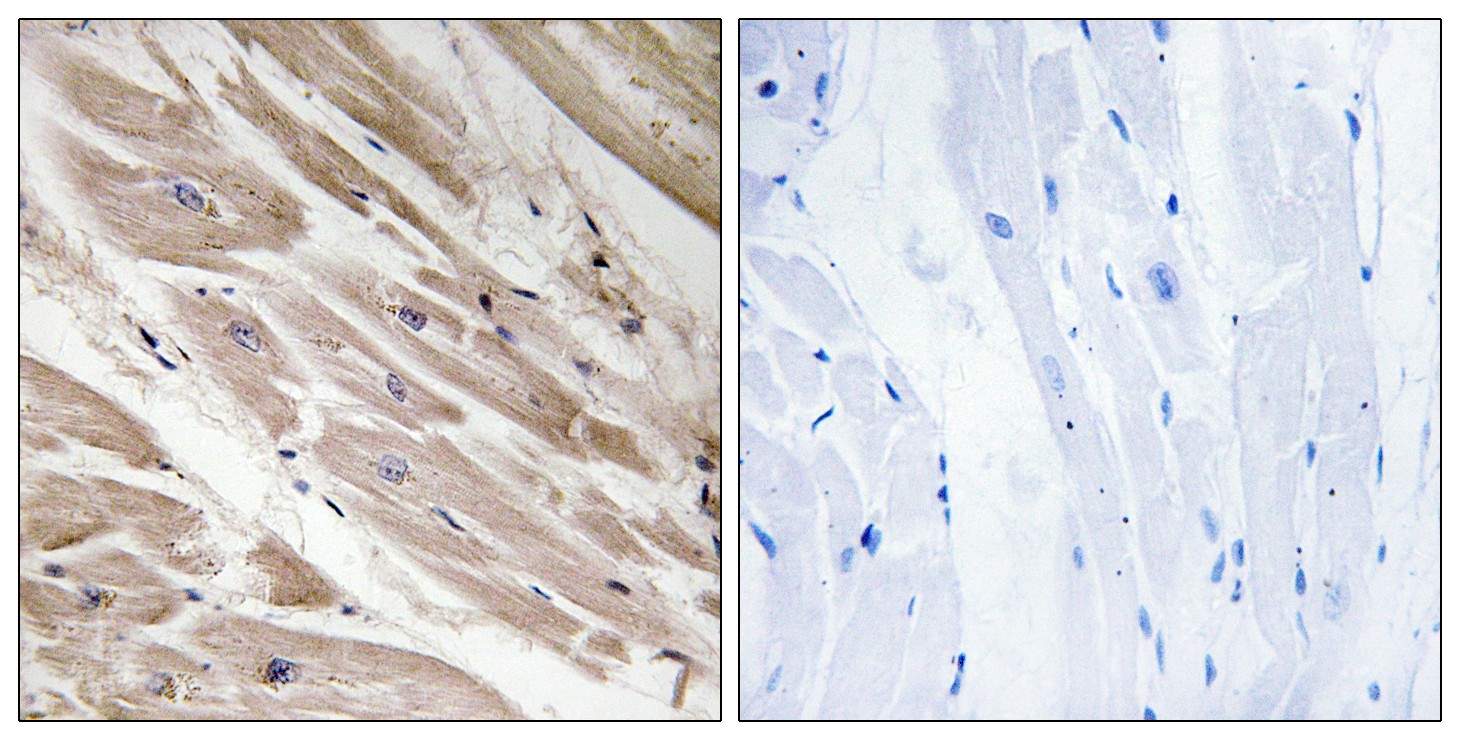 MYBPC3 Polyclonal Antibody