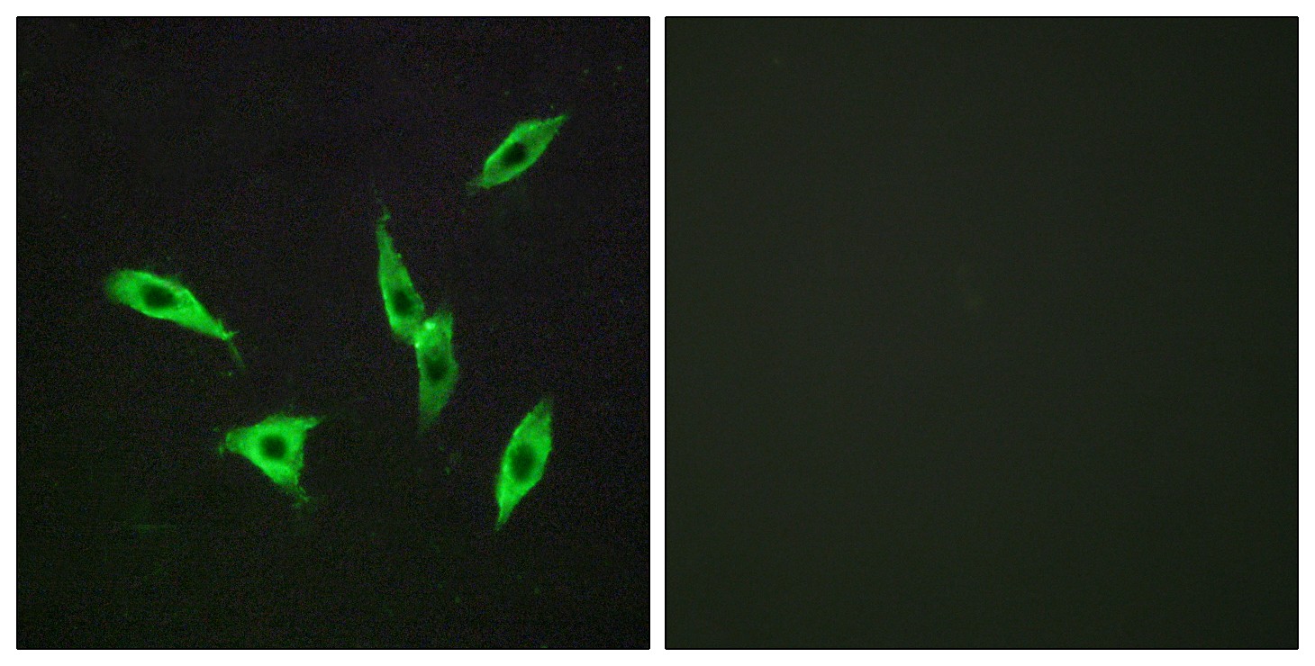 Adenosine A2B-R Polyclonal Antibody