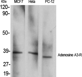 Adenosine A3-R Polyclonal Antibody