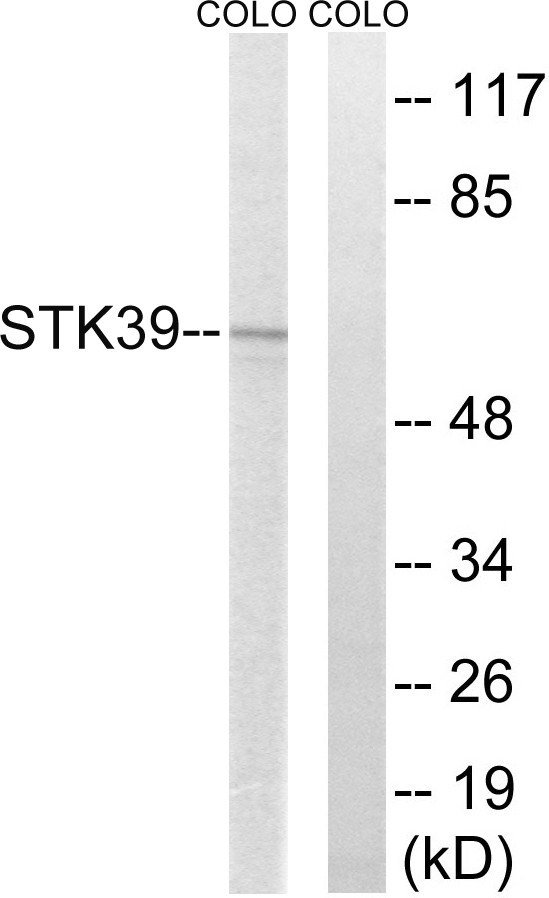 SPAK Polyclonal Antibody