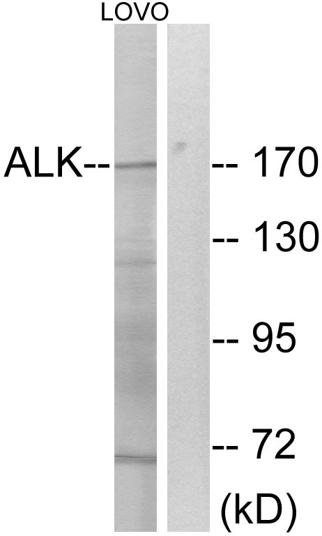 ALK Polyclonal Antibody