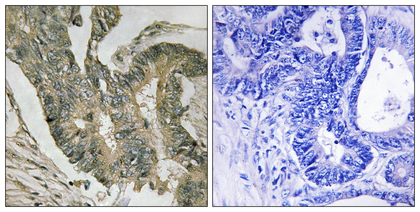 Aldolase C Polyclonal Antibody