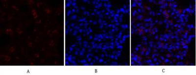 HSP A5 Polyclonal Antibody