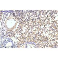 LC3B Polyclonal Antibody