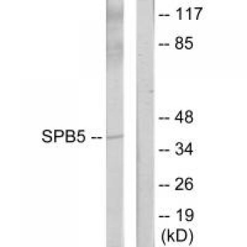 Maspin Polyclonal Antibody