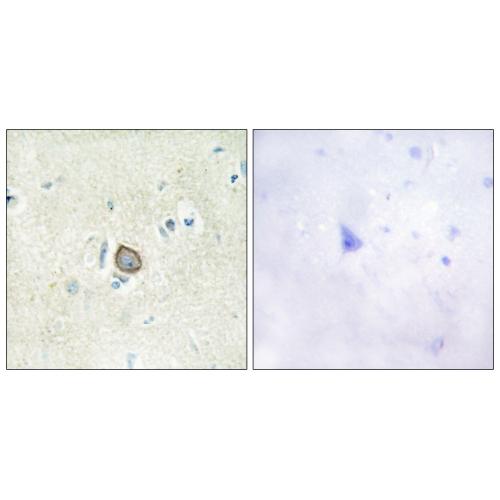 CDHF11 Polyclonal Antibody