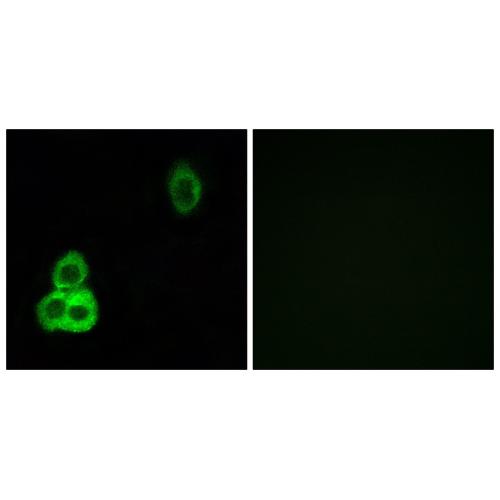 CDHF9 Polyclonal Antibody