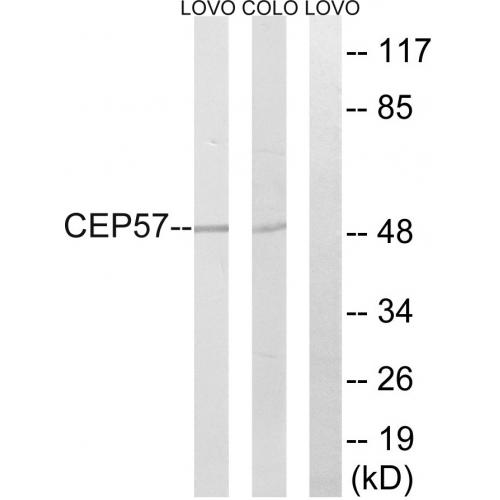 CEP57 Polyclonal Antibody