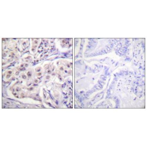 hnRNP D0 Polyclonal Antibody