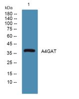 A4GAT Polyclonal Antibody