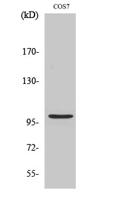 AAK1 Polyclonal Antibody