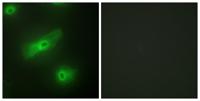 APRIL Polyclonal Antibody