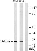 APRIL Polyclonal Antibody