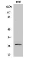 AQP0 Polyclonal Antibody