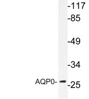 AQP0 Polyclonal Antibody