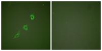 HSP10 Polyclonal Antibody