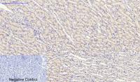 HSP27 Polyclonal Antibody