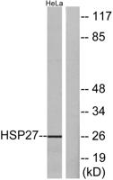 HSP27 Polyclonal Antibody