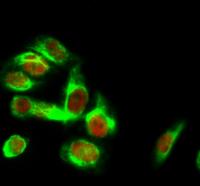 HSP40 Polyclonal Antibody