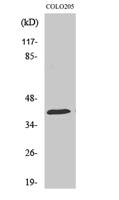 HSP40 Polyclonal Antibody