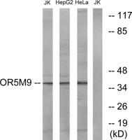 Olfactory receptor 5M9 Polyclonal Antibody