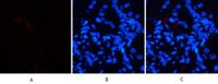 HSP70 Polyclonal Antibody