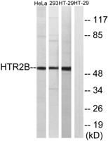 SR-2B Polyclonal Antibody